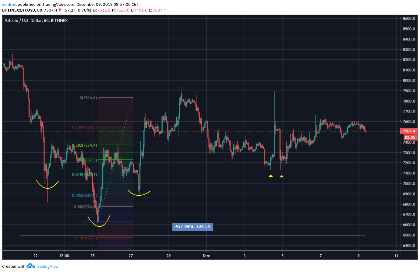 Head And Shoulders Bottom